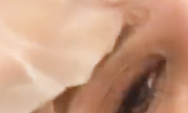 میکرودرم ابریژن و جوانسازی صورت